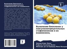 Bookcover of Выявление биопленок у коагулазоотрицательных стафилококков и их взаимосвязь