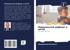 Bookcover of Марциальный дефицит у детей