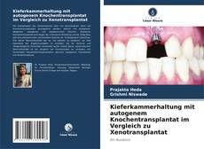 Capa do livro de Kieferkammerhaltung mit autogenem Knochentransplantat im Vergleich zu Xenotransplantat 
