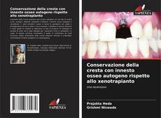 Buchcover von Conservazione della cresta con innesto osseo autogeno rispetto allo xenotrapianto