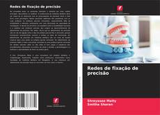 Couverture de Redes de fixação de precisão