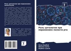 Bookcover of Роль цитологии при поражениях полости рта