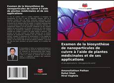 Copertina di Examen de la biosynthèse de nanoparticules de cuivre à l'aide de plantes médicinales et de ses applications