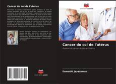 Buchcover von Cancer du col de l'utérus