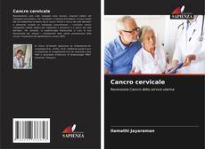 Buchcover von Cancro cervicale