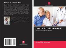 Copertina di Cancro do colo do útero