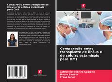 Buchcover von Comparação entre transplante de ilhéus e de células estaminais para DM1