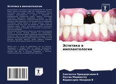 Bookcover of Эстетика в имплантологии
