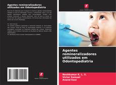 Buchcover von Agentes remineralizadores utilizados em Odontopediatria