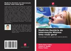 Medicina Dentária de Intervenção Mínima: Uma visão geral kitap kapağı