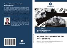 Copertina di Augmentation des horizontalen Alveolarkamms