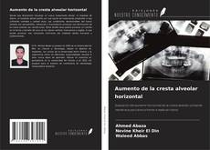 Bookcover of Aumento de la cresta alveolar horizontal