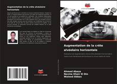 Augmentation de la crête alvéolaire horizontale kitap kapağı