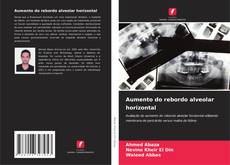 Bookcover of Aumento do rebordo alveolar horizontal