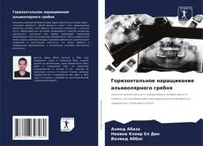 Bookcover of Горизонтальное наращивание альвеолярного гребня