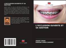 Bookcover of L'OCCLUSION OUVERTE ET SA GESTION