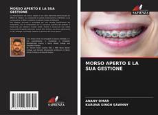 Buchcover von MORSO APERTO E LA SUA GESTIONE