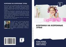 Bookcover of КОРОНКИ НА КОРЕННЫЕ ЗУБЫ