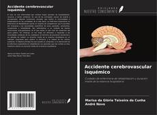 Accidente cerebrovascular isquémico kitap kapağı