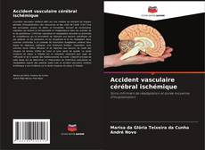 Copertina di Accident vasculaire cérébral ischémique