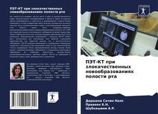 Bookcover of ПЭТ-КТ при злокачественных новообразованиях полости рта