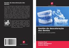Bookcover of Gestão da descoloração dos dentes