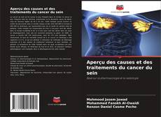 Buchcover von Aperçu des causes et des traitements du cancer du sein