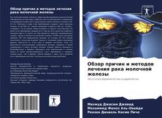 Buchcover von Обзор причин и методов лечения рака молочной железы
