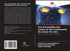 Buchcover von Vue d'ensemble des causes et des traitements du cancer du sein