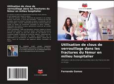 Bookcover of Utilisation de clous de verrouillage dans les fractures du fémur en milieu hospitalier