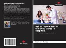 Buchcover von Use of locked nails in femur fractures in hospitals