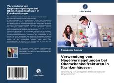 Capa do livro de Verwendung von Nagelverriegelungen bei Oberschenkelfrakturen in Krankenhäusern 