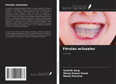 Copertina di Férulas oclusales