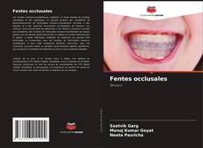 Buchcover von Fentes occlusales