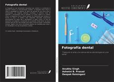 Bookcover of Fotografía dental