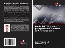 Bookcover of Ruolo del TGF-β nella patogenesi della fibrosi sottomucosa orale