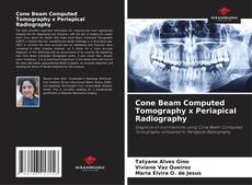 Capa do livro de Cone Beam Computed Tomography x Periapical Radiography 