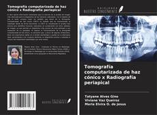 Buchcover von Tomografía computarizada de haz cónico x Radiografía periapical