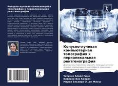 Capa do livro de Конусно-лучевая компьютерная томография x периапикальная рентгенография 