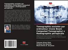 Portada del libro de Tomographie assistée par ordinateur (Cone Beam Computed Tomography) x Radiographie périapicale