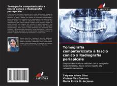 Buchcover von Tomografia computerizzata a fascio conico x Radiografia periapicale
