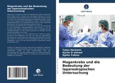 Buchcover von Magenkrebs und die Bedeutung der laparoskopischen Untersuchung