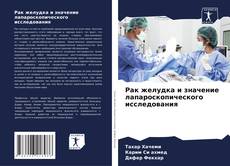 Buchcover von Рак желудка и значение лапароскопического исследования