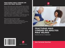 Bookcover of FRACTURAS MAIS COMUNS EM ADULTOS MAIS VELHOS