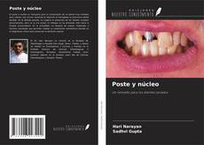 Bookcover of Poste y núcleo