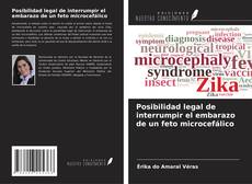 Copertina di Posibilidad legal de interrumpir el embarazo de un feto microcefálico