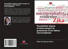 Possibilité légale d'interrompre la grossesse d'un fœtus microcéphale kitap kapağı