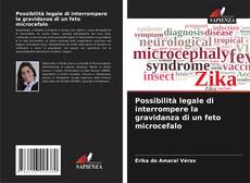 Bookcover of Possibilità legale di interrompere la gravidanza di un feto microcefalo