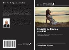 Buchcover von Embolia de líquido amniótico