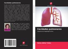 Buchcover von Cavidades pulmonares